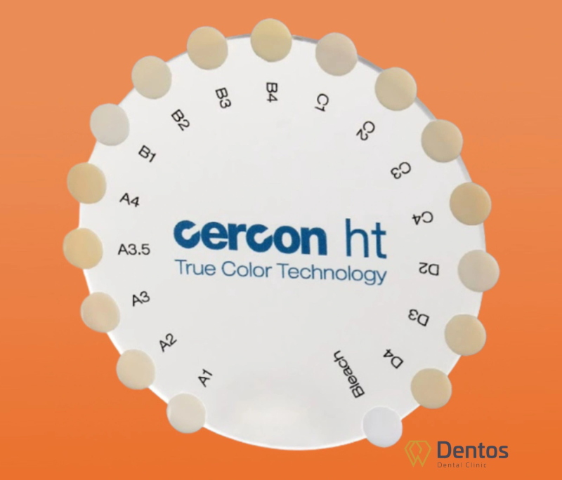 Điểm độc đáo của răng sứ Cercon là công nghệ màu sắc True Color độc quyền